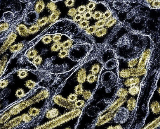 已有290万病例 美国流感季刚刚开始